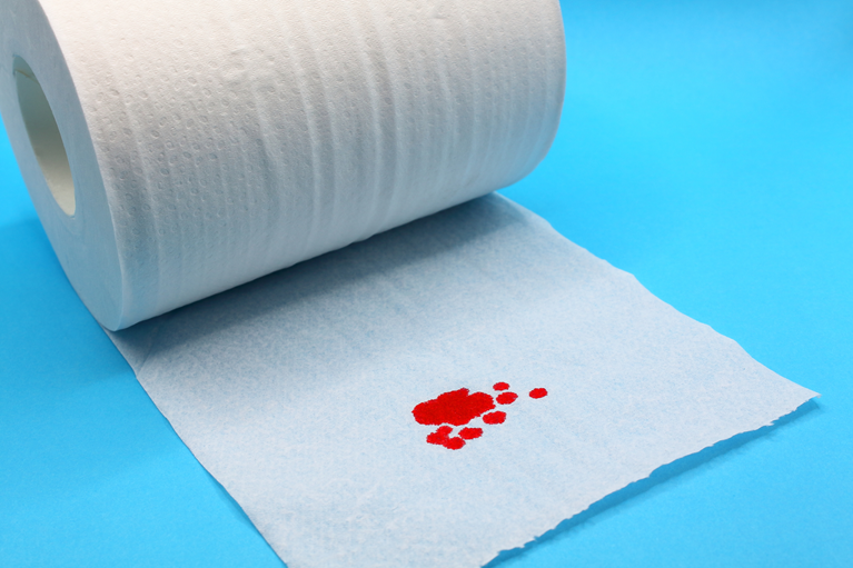 血便が出たけれど痛みがない場合も注意が必要です