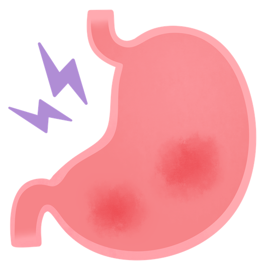 胃炎とはどんな病気？