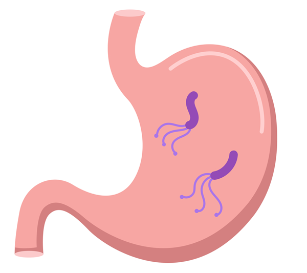 ピロリ菌とは？なぜ除菌が必要なのか