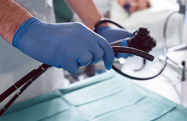 COLONOSCOPY 大腸カメラ（大腸内視鏡検査）