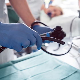 COLONOSCOPY 大腸カメラ（大腸内視鏡検査）