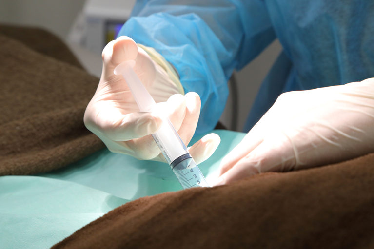 ジオン注射（ALTA療法）とは