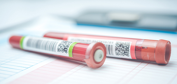 MEDICAL CHECKUP 健康診断・定期健診（特定健診・胃がん/大腸がん検診など）